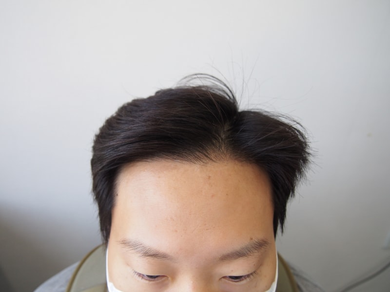 第4个月后期