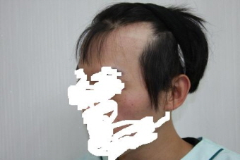 오른쪽 전 페이스.JPG