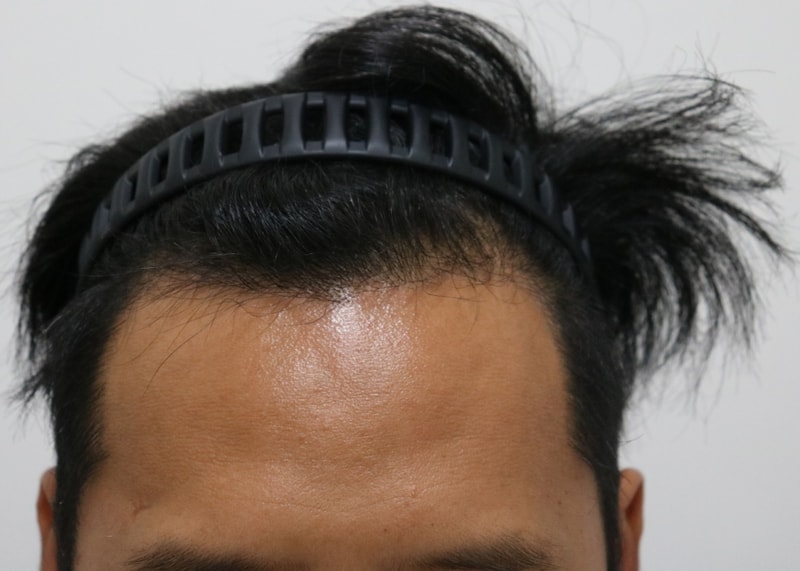 수술정면_수정.jpg
