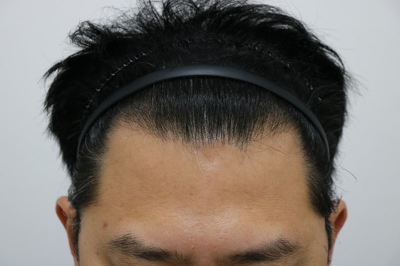 후1.jpg