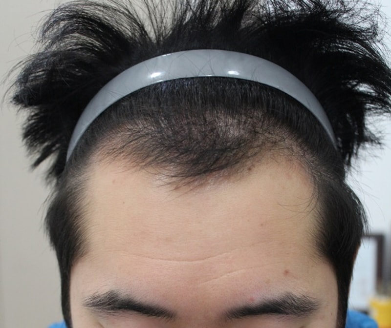 후2.JPG