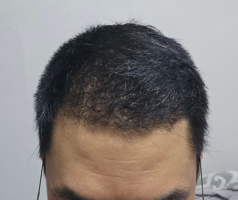 1000013854.jpg