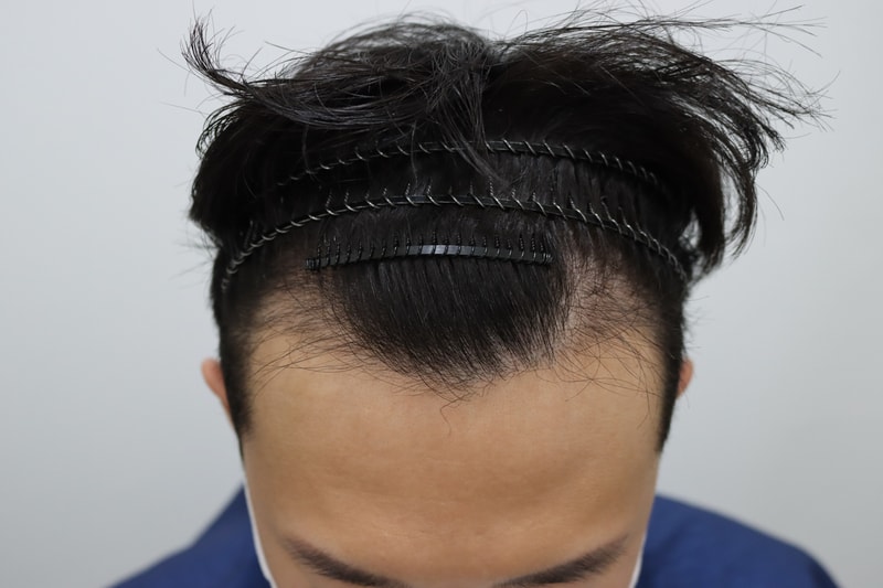 1648545038735.jpg