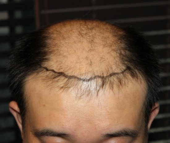 수술전.jpg