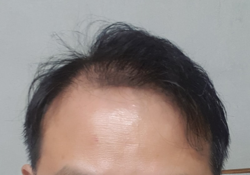 정면.jpg