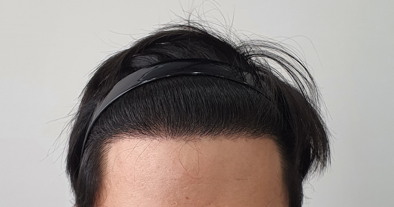 Non-cut 2090 Hair follicle 240th day review
