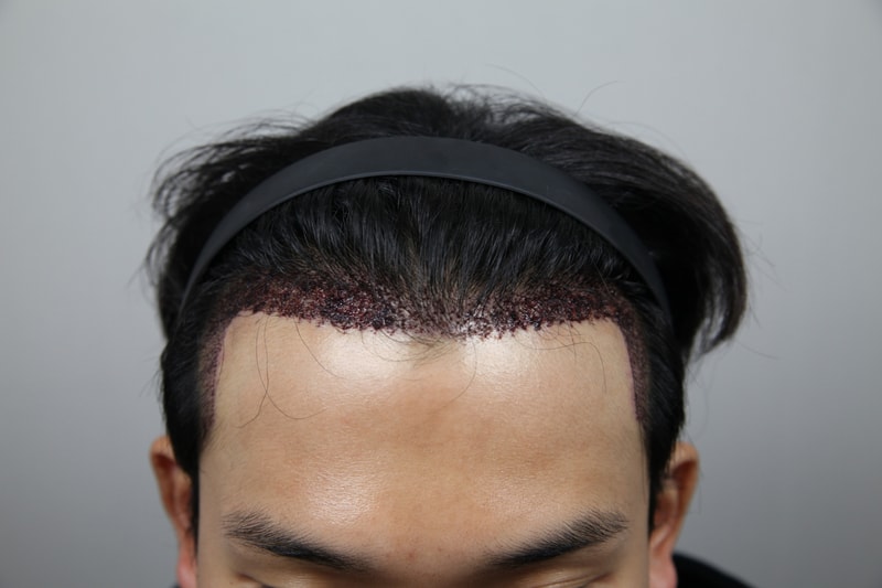 포토후기 이미지