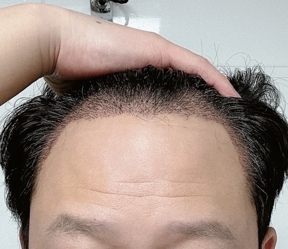 꾸미기김성수_정면_후.jpg