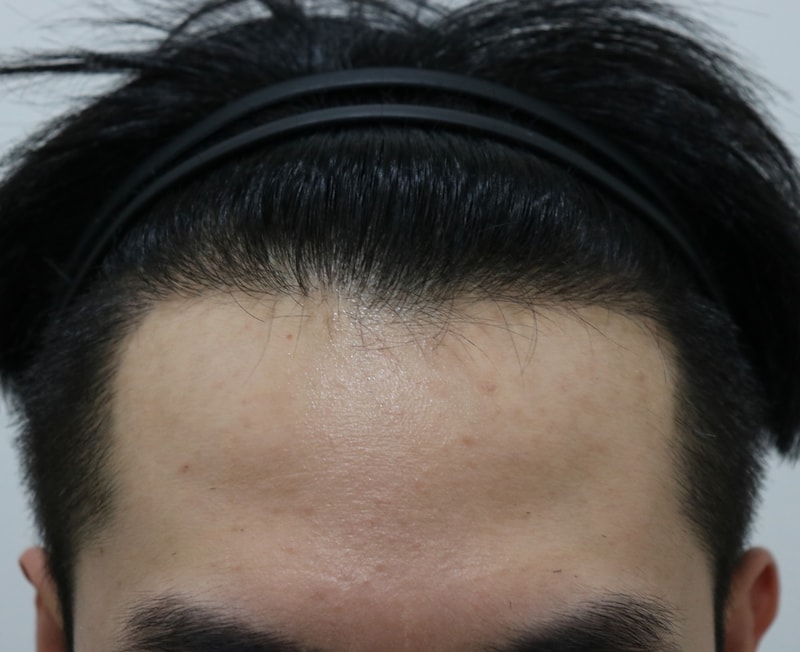 密密麻麻 已经9个月了