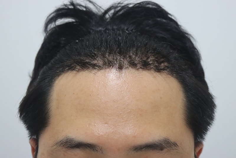 15일.jpg