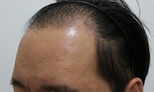 수술전2.jpg