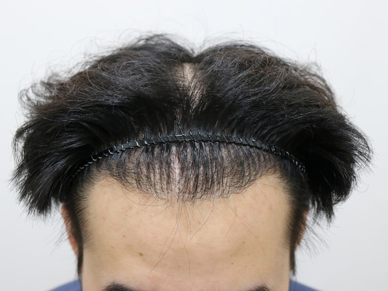 수술 전 2.jpg