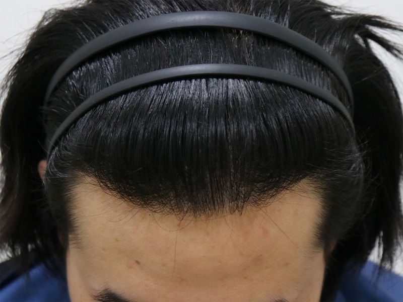 수술 후 2.jpg