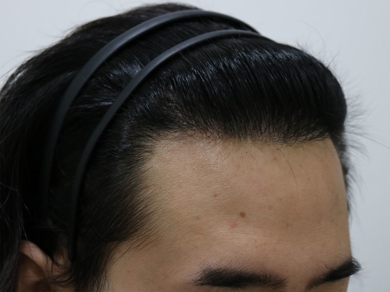 수술 후 3.jpg
