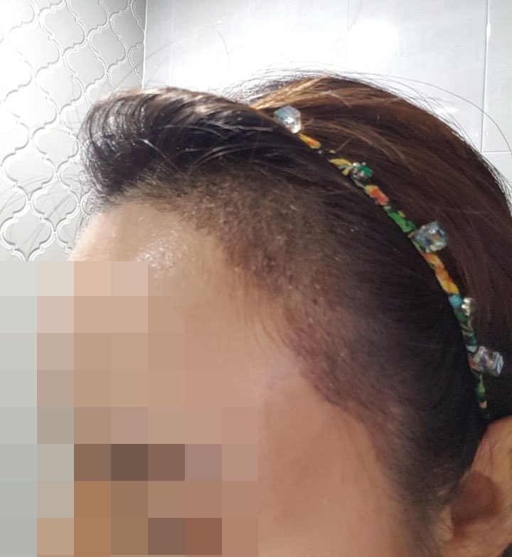 20180224_12일_왼쪽.jpg