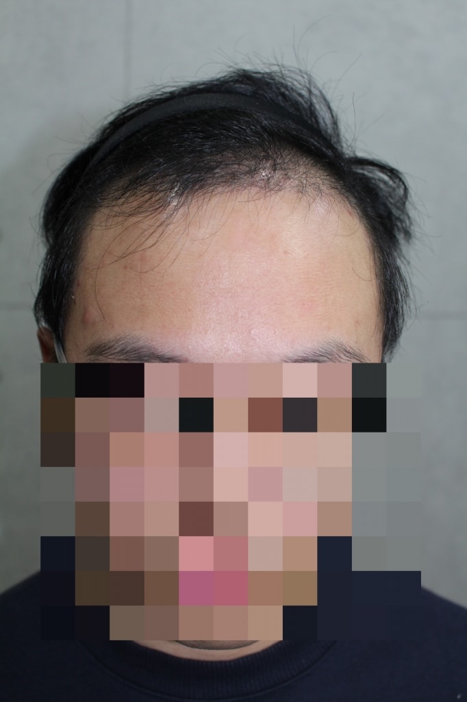 f.JPG