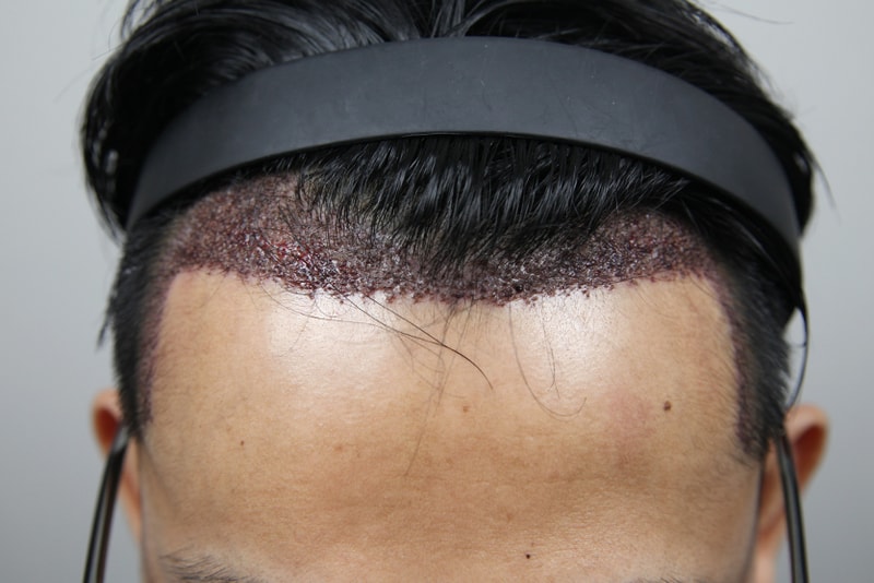 포토후기 이미지