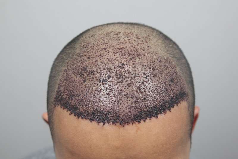 포토후기 이미지