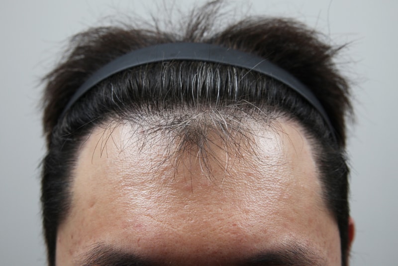 포토후기 이미지