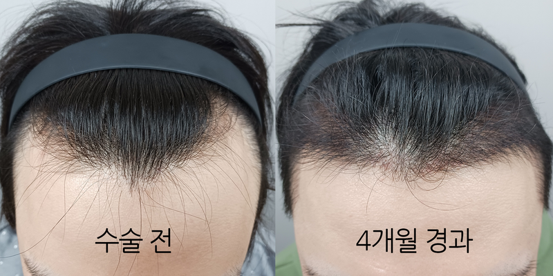 암흑기 끝나고 머리 잘 올라왔네요~ 앞으로 더 기대가 됩니다~
