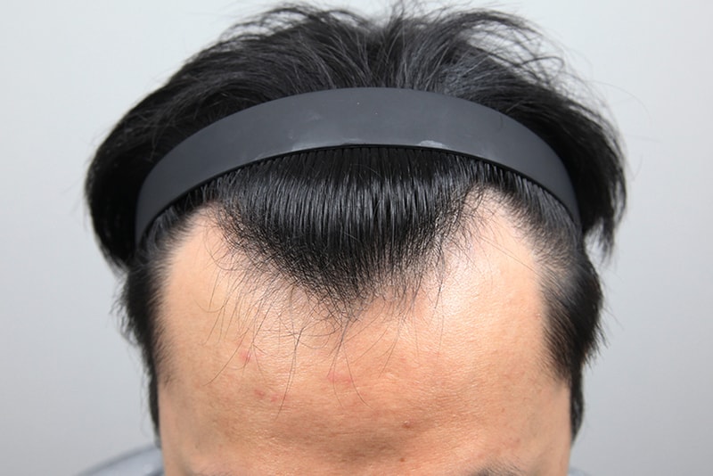 포토후기 이미지