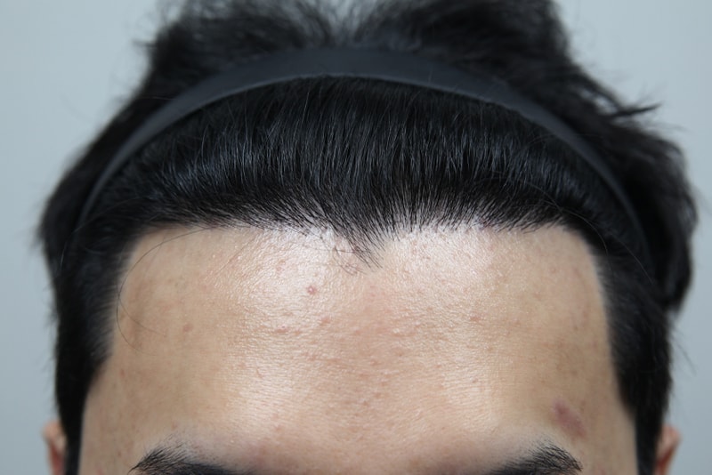 포토후기 이미지