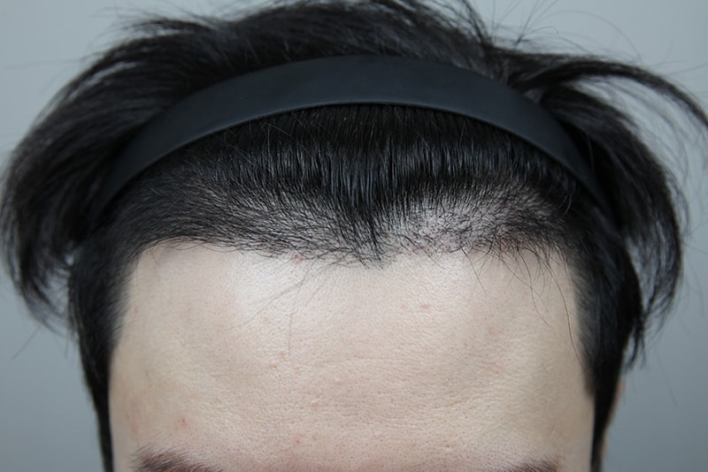 포토후기 이미지