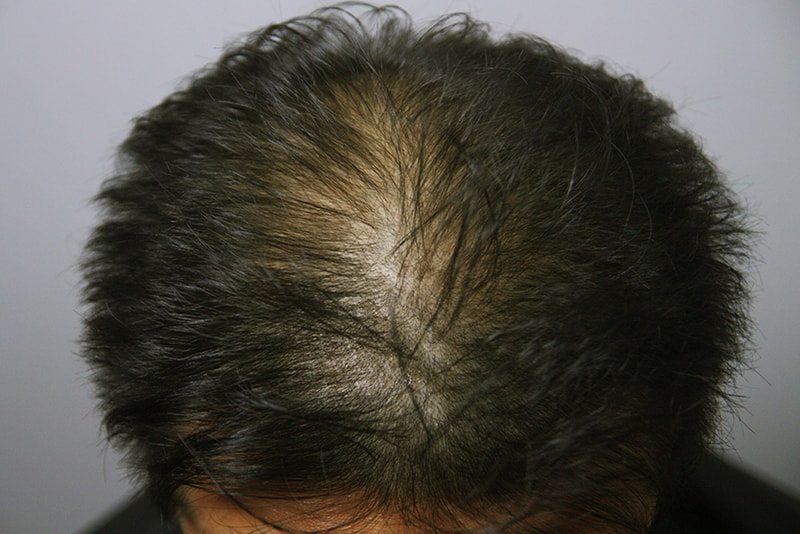 포토후기 이미지