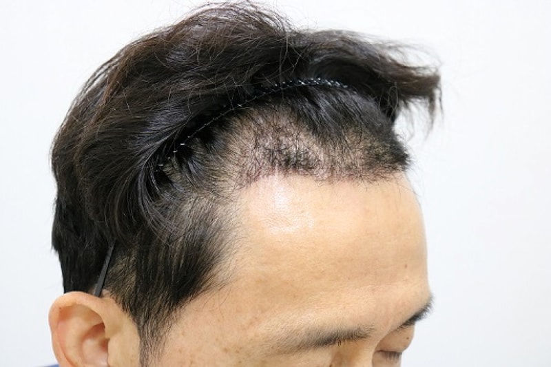 후10.jpg