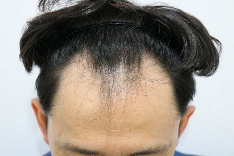 후1.jpg