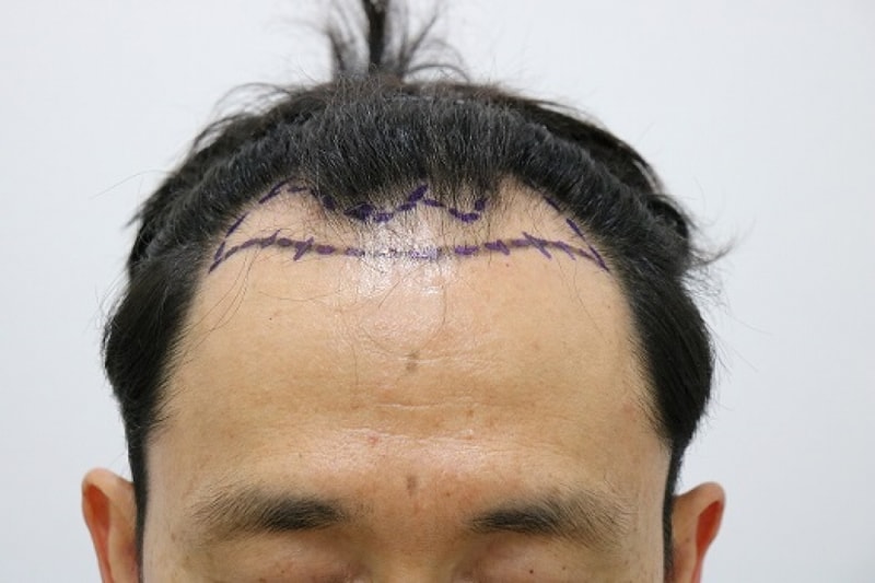 후7.jpg
