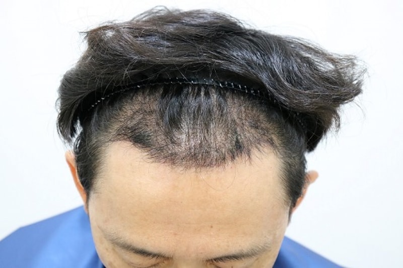 후12.jpg