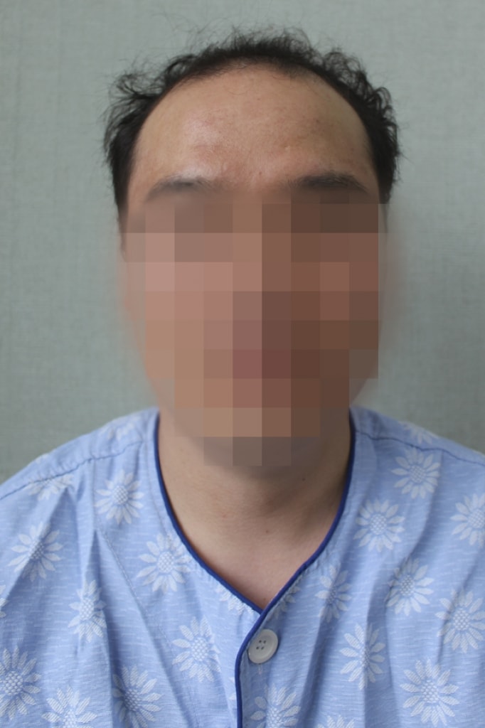 수술전_2.jpg