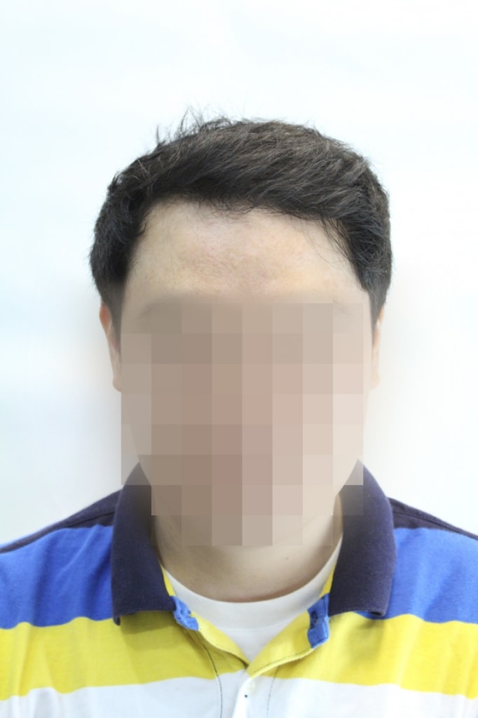 수술후_1.jpg