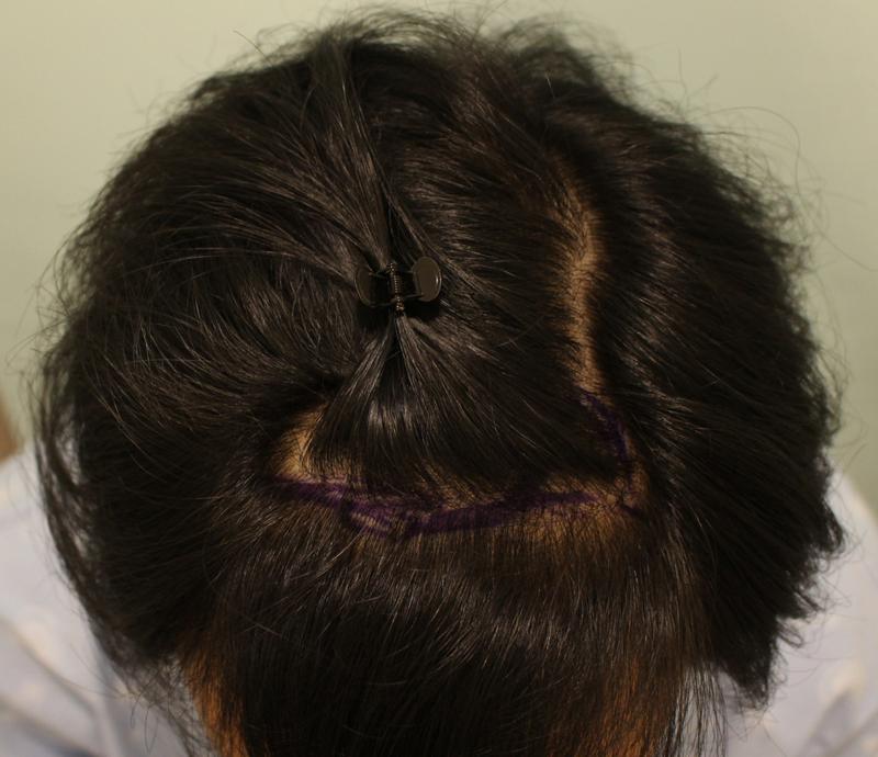 Jeondubu & Jeongsu density reinforcement satisfactory 8 months review~