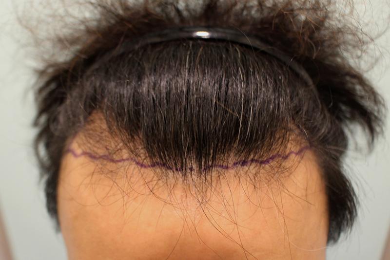 MJ, I filled in the top of the head