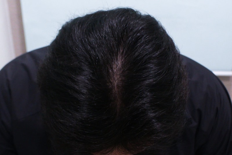 정수리_2.jpg