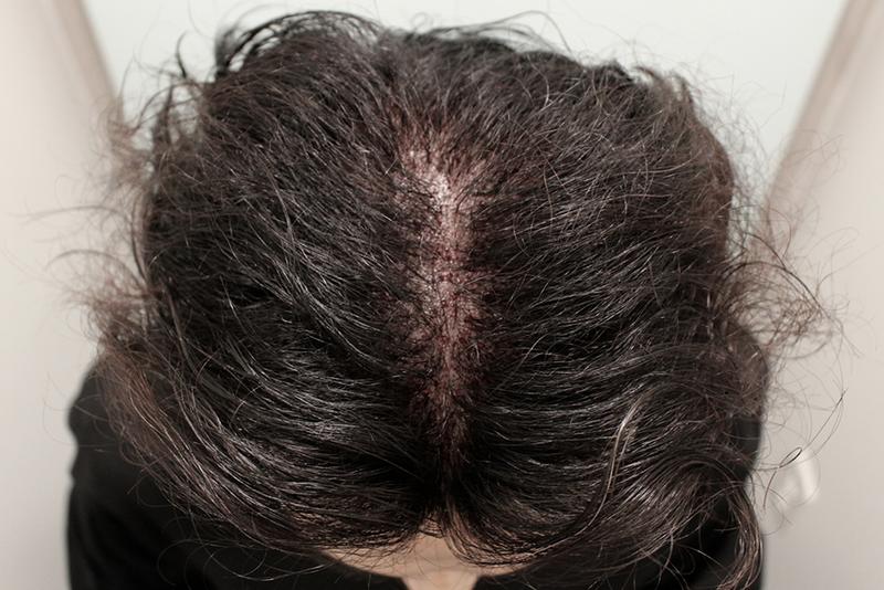 MJ, the top of the head is half a year. Satisfied