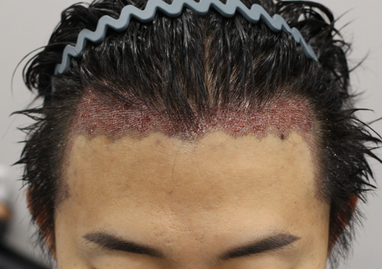 화면 캡처 2024-11-11 185756.png