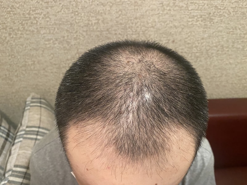 KakaoTalk_20220801_134837673_05.jpg