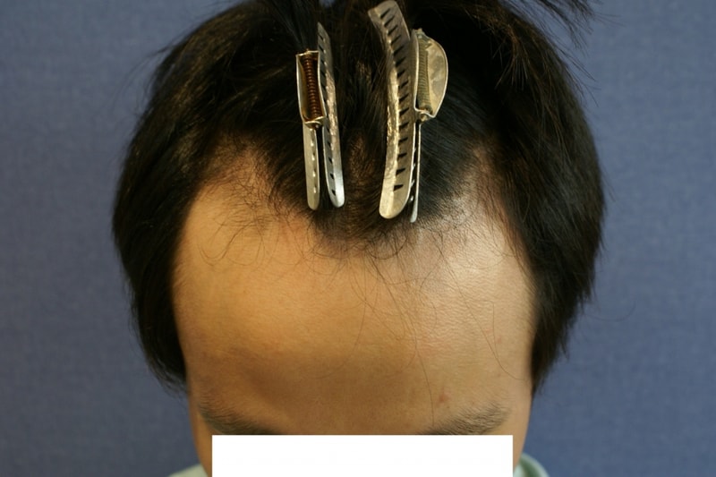1차.JPG