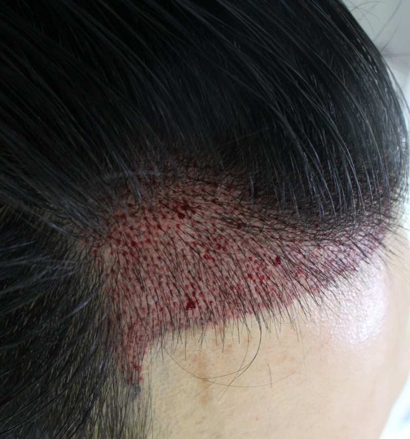 수술후3.jpg