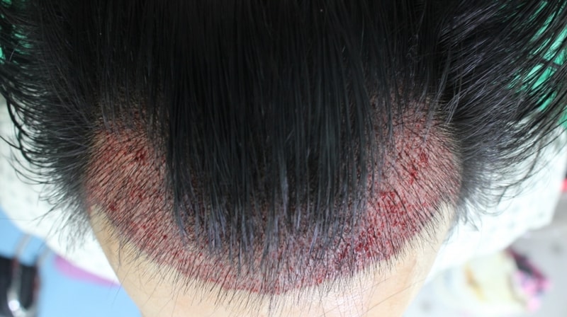 수술후1.jpg
