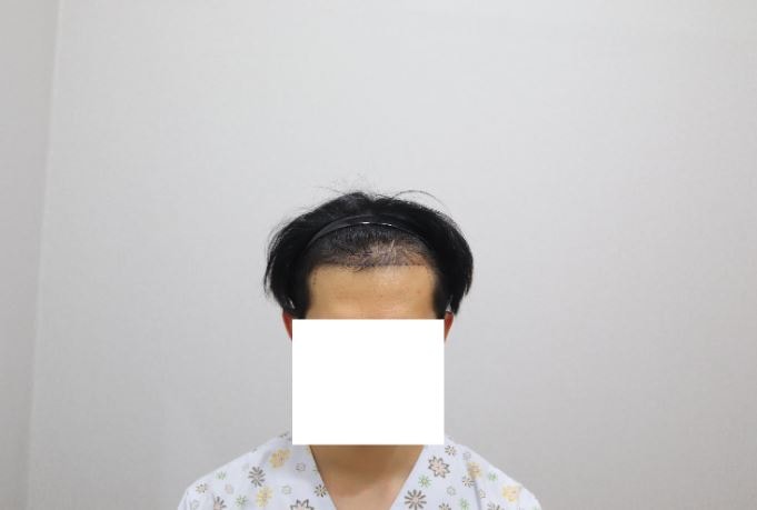디자인 후_정면.JPG