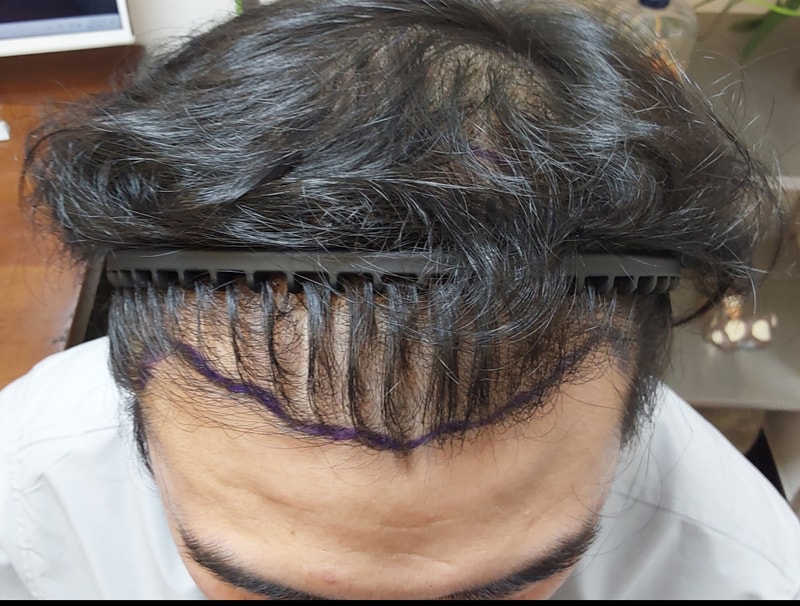 1000002015.jpg