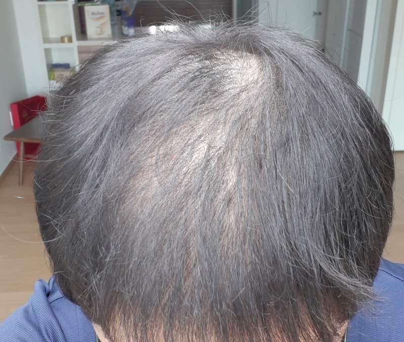 머리2.jpg