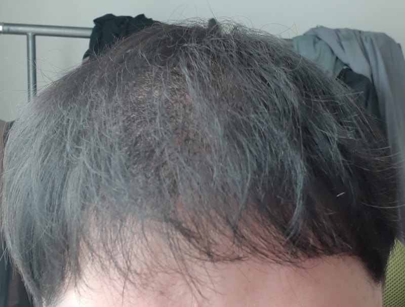 머리35.jpg
