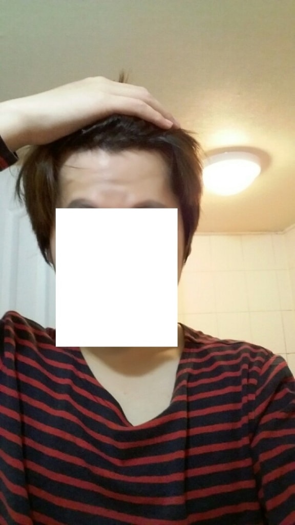 수술후1.jpg