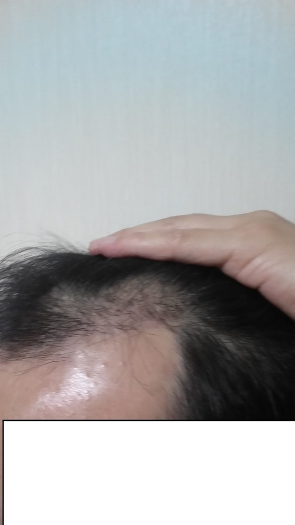 좌측면2.jpg