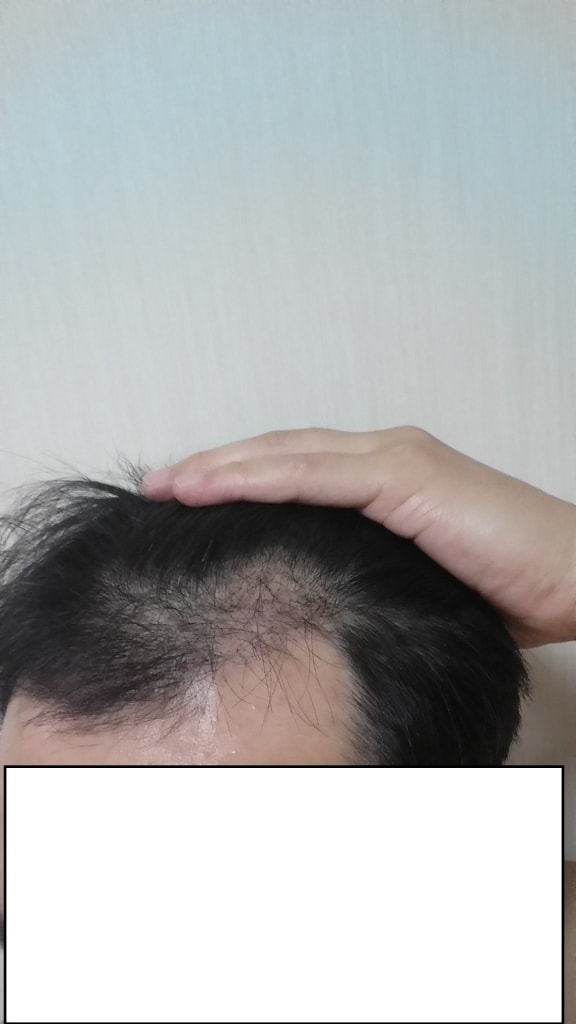 좌측면1.jpg